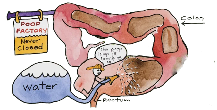 How Much Does a Colon Cleanse Cost?